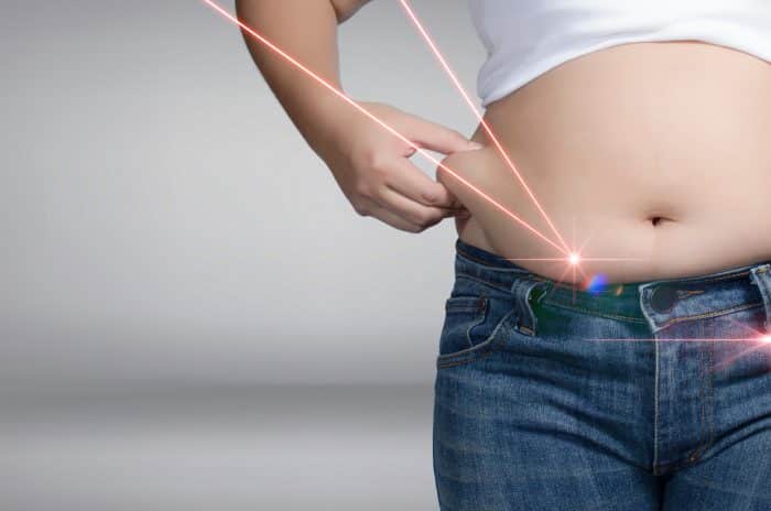 laser lipo weight loss