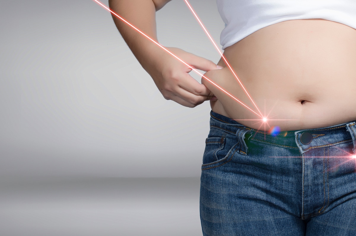 laser lipo weight loss