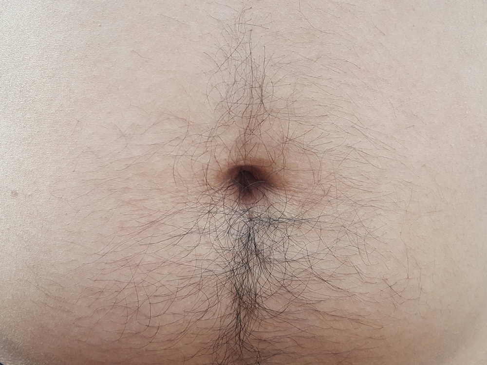 FUPA Surgery, Pubic Area Liposuction