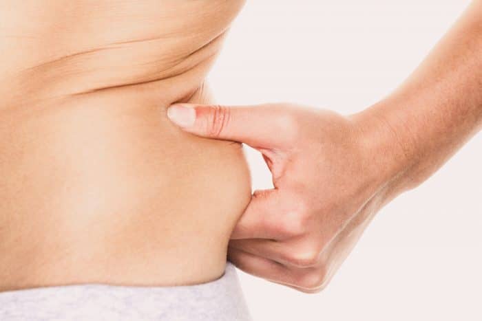 A person pinches the fat deposit on their waist