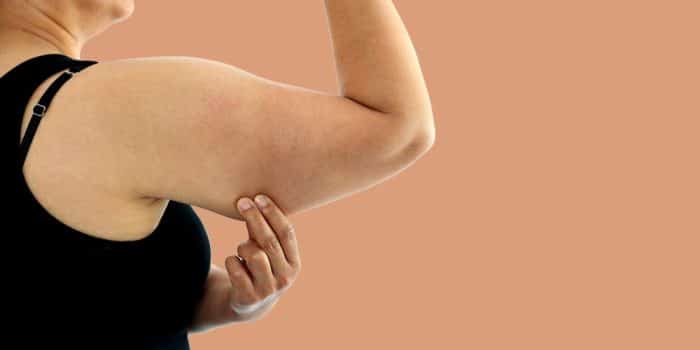 Woman grabbing fat on right arm