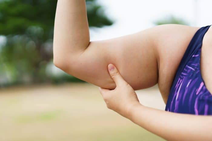 Woman holding skin on right arm, assessing amount of fat on her bicep