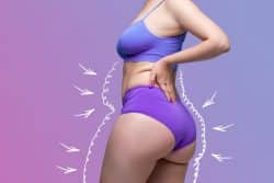 Woman with purple undergarments with lines around her showing where fat used to be.