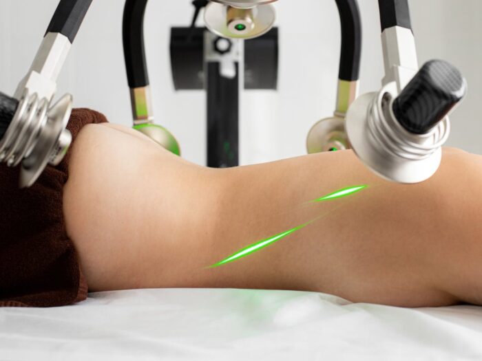 Cold Laser Therapy