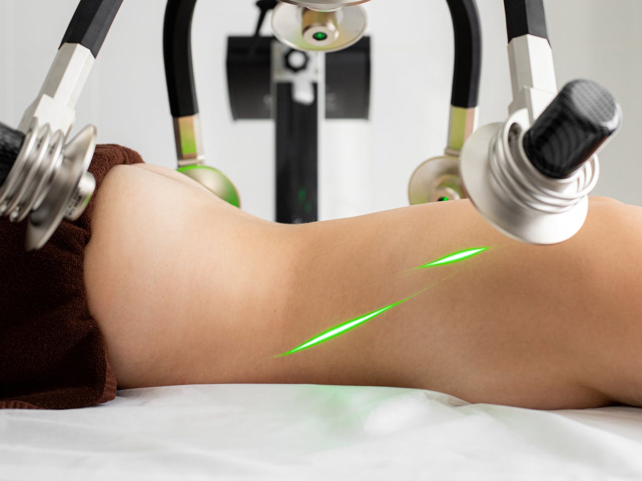 Cold Laser Therapy