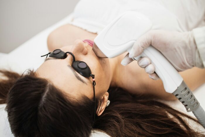 Laser Treatment