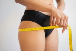 laser body sculpting