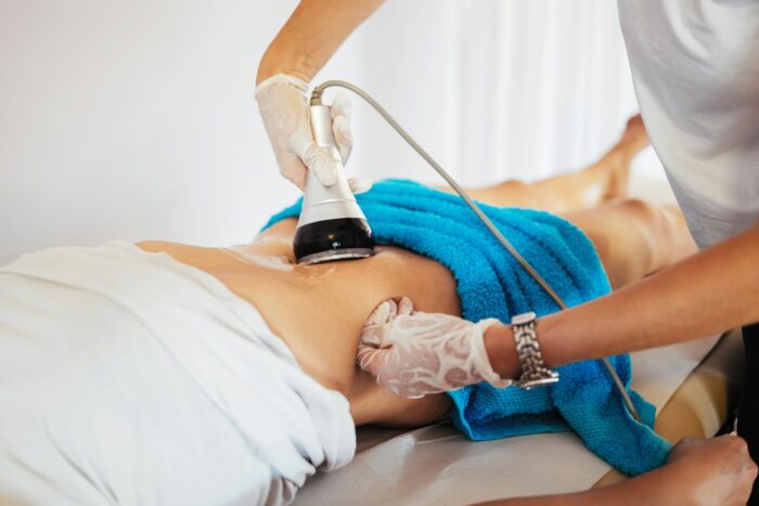 laser lipo